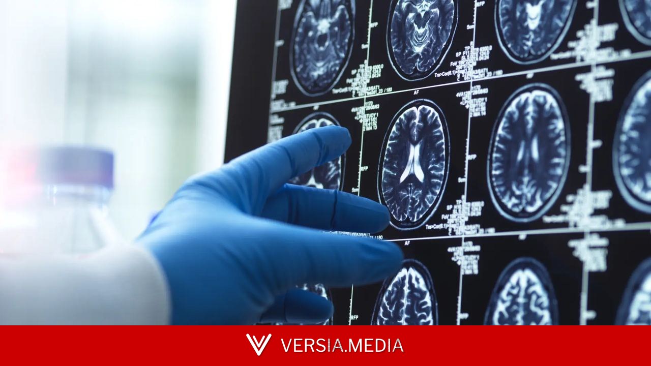 Un estudio de la UCLM aporta nuevas claves sobre el deterioro cerebral inicial en la enfermedad de Alzheimer